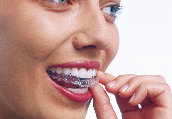 Invisalign Teeth Straightening Examination & $1,100 Off Standard Invisalign Treatment