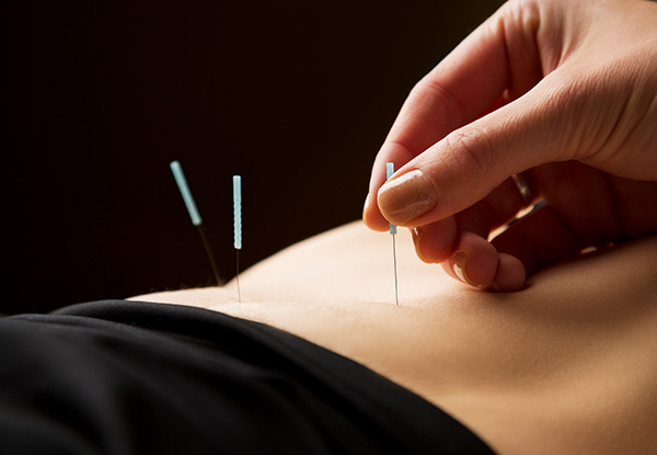 40-Minute Relaxation Acupuncture Treatment for One Person