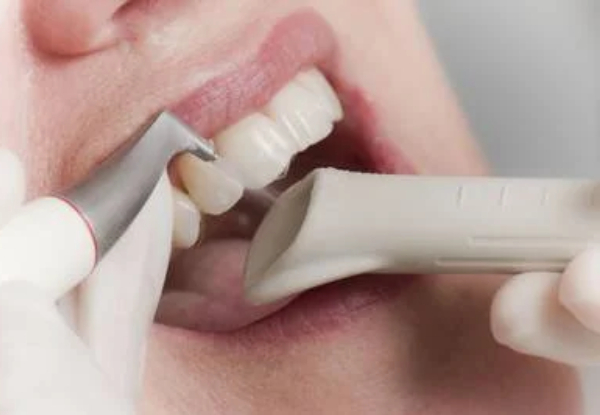 Airflow Hygienist Appointment incl. Scale, Clean & Polish