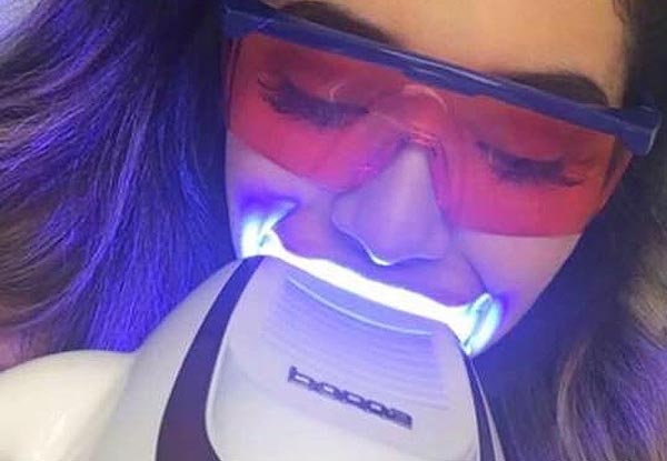 75-Minute Beyond Laser Teeth Whitening -
 Options for 90-Minute Beyond Laser Teeth Whitening or for 75-Minute for Two People