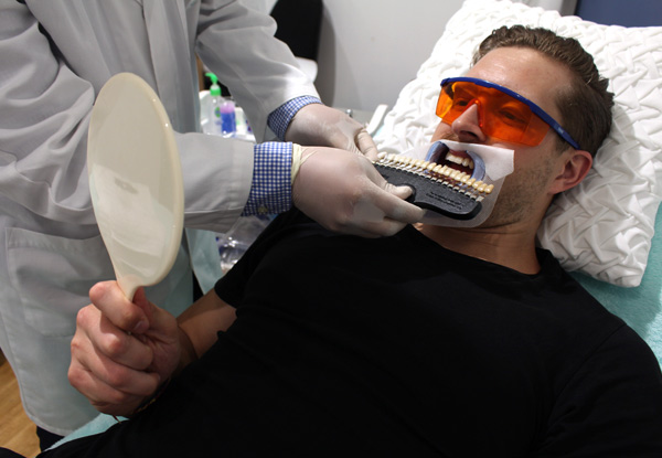 Teeth Whitening Package - Options for Two People - Three Auckland Locations