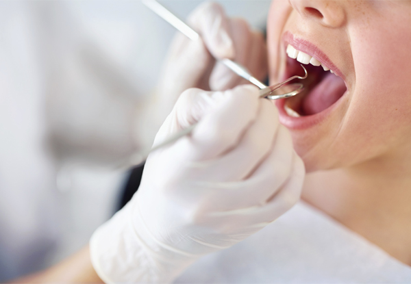 Dental Check-Up incl. Exam, Two X-Rays & Scale & Polish incl. a $50 Return Voucher