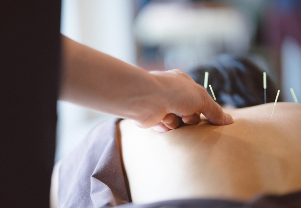 60-Minute Acupuncture Session for One Person