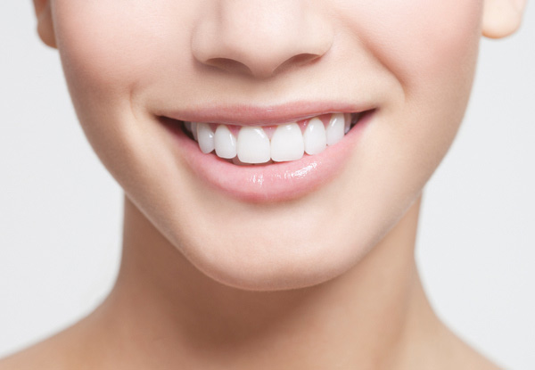 60-Minute Teeth Whitening Treatment - Option for 90-Minute