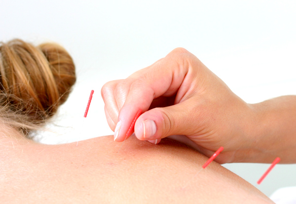 One-Hour Traditional Acupuncture - Option for One-Hour Cosmetic Acupuncture