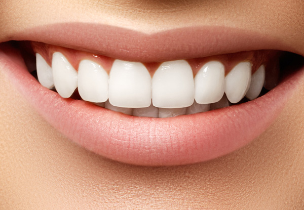 Examination, Two X-Rays, Scale Polish & Whitening Consultation incl. Take Home Teeth Whitening Kit Or Sports Mouth Guard - Mt Eden & Birkenhead Location