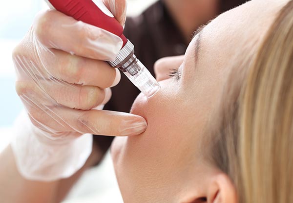 Medical Micro Skin Needling Collagen Induction Therapy - Options for up to Three Treatments