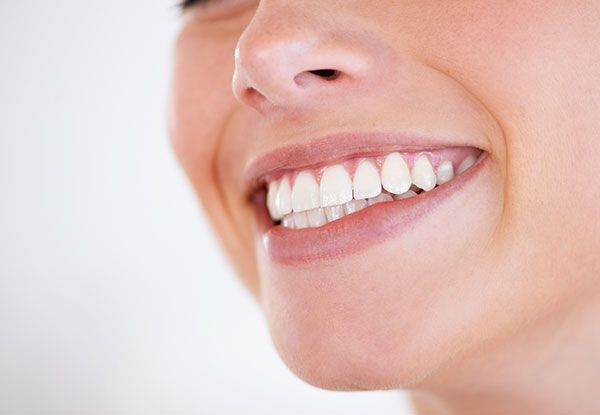 Dental Exam, Dental Scale, Clean, Polish & $50 Return Voucher - Options for Dental Exam Package