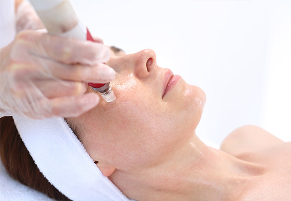 Full Face Collagen Therapy Micro Needling Session & Collagen Face Mask - Option for Two or Three Sessions