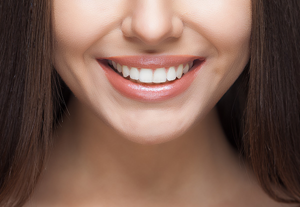 $49 for a Dental Check-Up incl. X-Rays & a $40 Return Voucher (value up to $163)