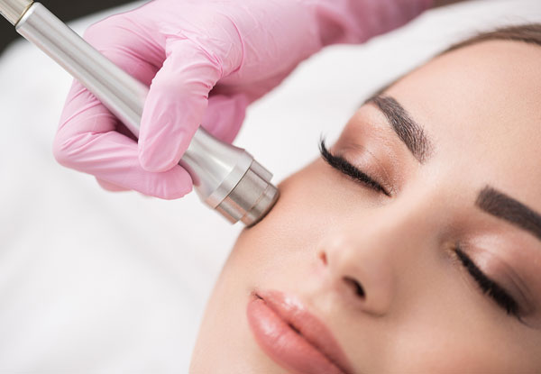 45-Minute Diamond Microdermabrasion Facial - Option to incl. an Active Complex Face Peel