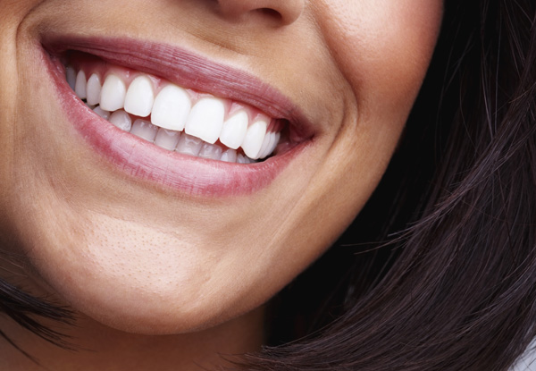 45-Minute UK-Made Non-Peroxide Laser Teeth Whitening Treatment for One Person - Option for 60-Minute Treatment for One Person or for Two People