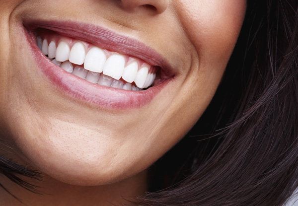 60-Minute UK-Made Peroxide-Free Laser Teeth Whitening Treatment for One Person - Option for 90-Minute Treatment & for Two People Available