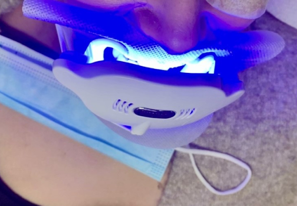 60-Minute Certified Teeth Whitening with Beyond 11 Ultra LED & Ultrasonic Technology for One Person