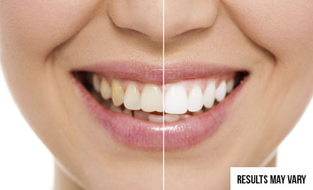 $99 for a 45-Minute Sensitivity & Pain Free LED Teeth Whitening Package, $139 for 60 Minutes or $159 for 90 Minutes - Four Wellington Locations  (value up to $649)