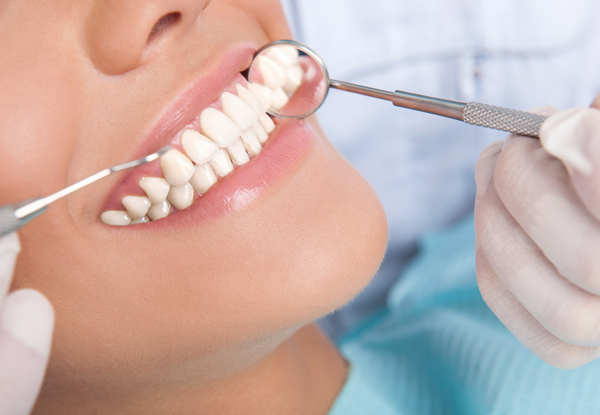 $49 for a Full Dental Exam Package incl. X-Rays & $40 Return Visit Voucher (value up to $135)