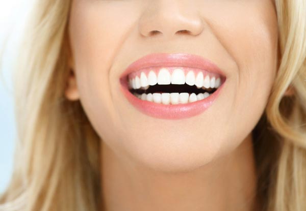45-Minute Polus Laser Teeth Whitening Treatments - Options for 60 Minutes, 30-Minute Ultrasound Premium Treatment & Option for Two