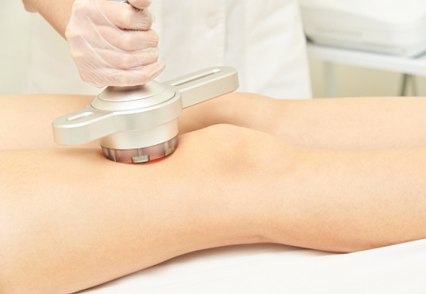 30-Minute Non-Surgical Cavitation Lipo Bodysculpting Treatment incl. Consultation - Options for up to Five Treatments