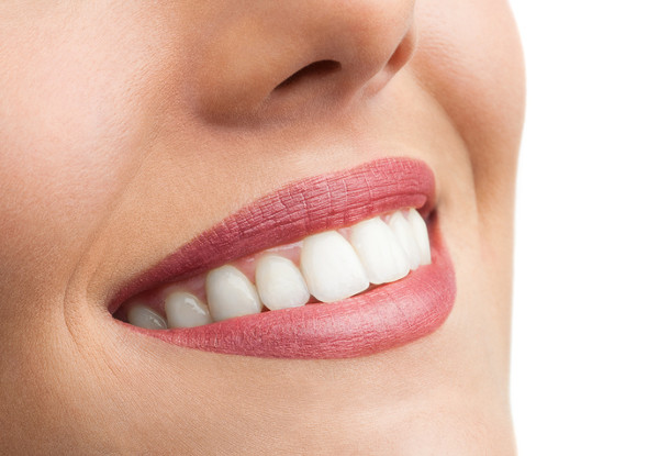 Express 30-Minute Mobile Cosmetic Teeth Whitening - Options for 60-Minute, 90-Minute or Two 60-Minute Sessions