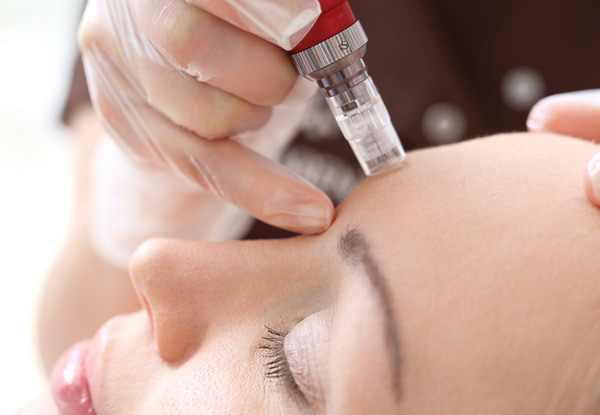 Dermal Filler with Micro Needling Pen Treatment for the Face -  Options for Two Treatments