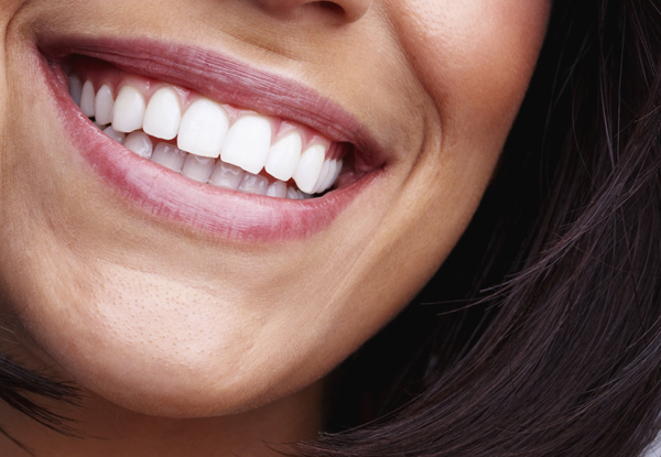 From $129 for a Dental Exam & One Full Tooth Filling – Options to incl. up to Three Full Tooth Fillings, X-Rays, Scale & Polish Available (value up to $999)