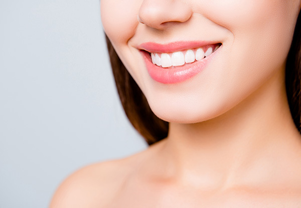 Deluxe Teeth Whitening Touch Up Session incl. Initial Consultation & $20 Return Voucher - Options for Gold Session, Platinum Session or Diamond Session & Sensitive Teeth