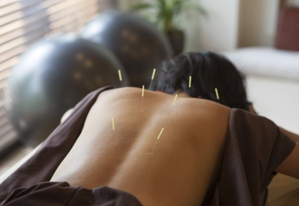 One-Hour Acupuncture Treatment - Option for ACC or Private Treatment